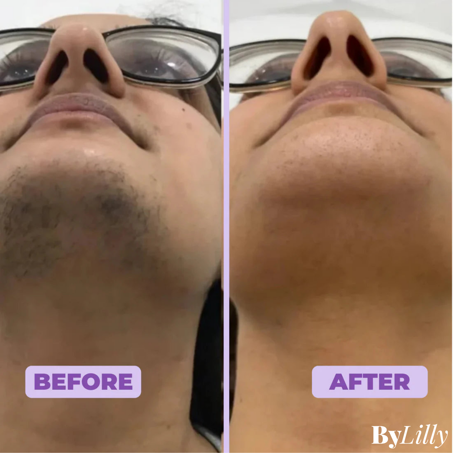 ByLilly Facial Hair Removal Cream