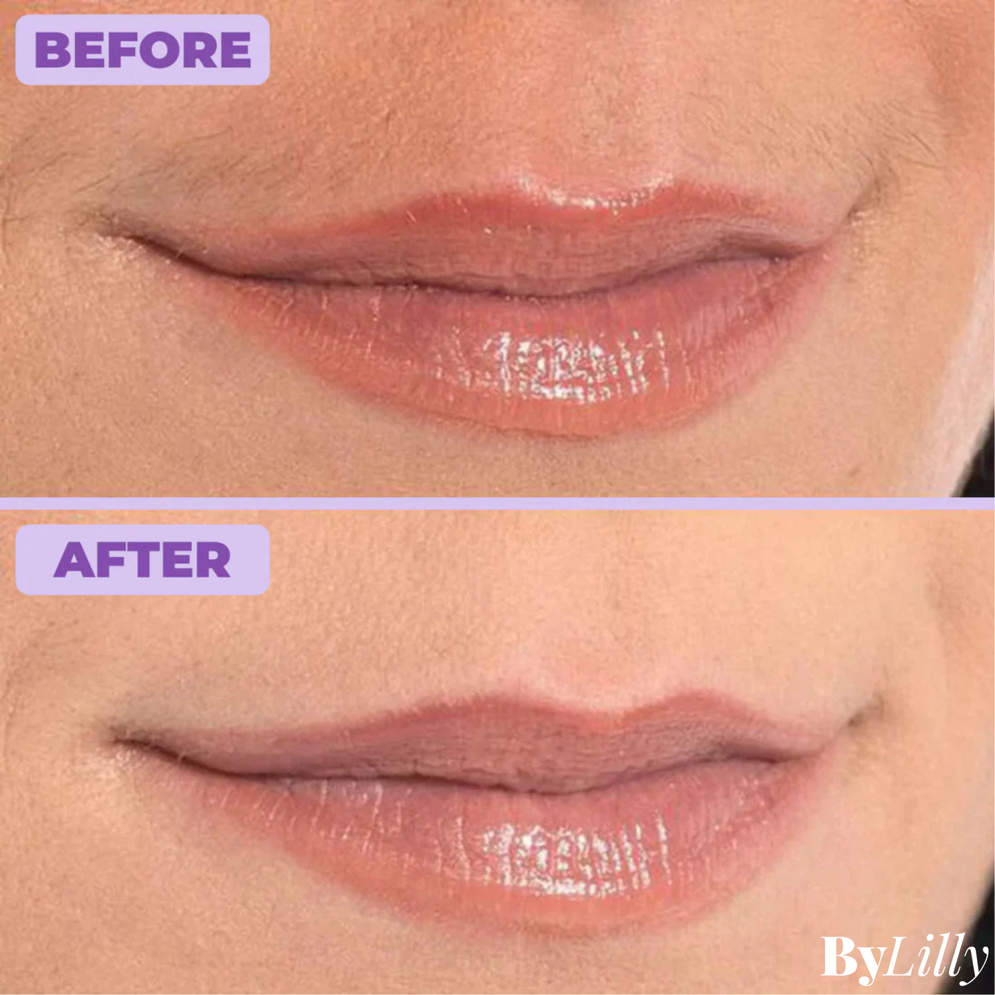 ByLilly Facial Hair Removal Cream